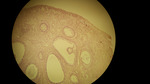 MISSING THUMBNAIL